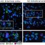 Look across just a few brain areas discerns Alzheimer’s vulnerability and resilience components